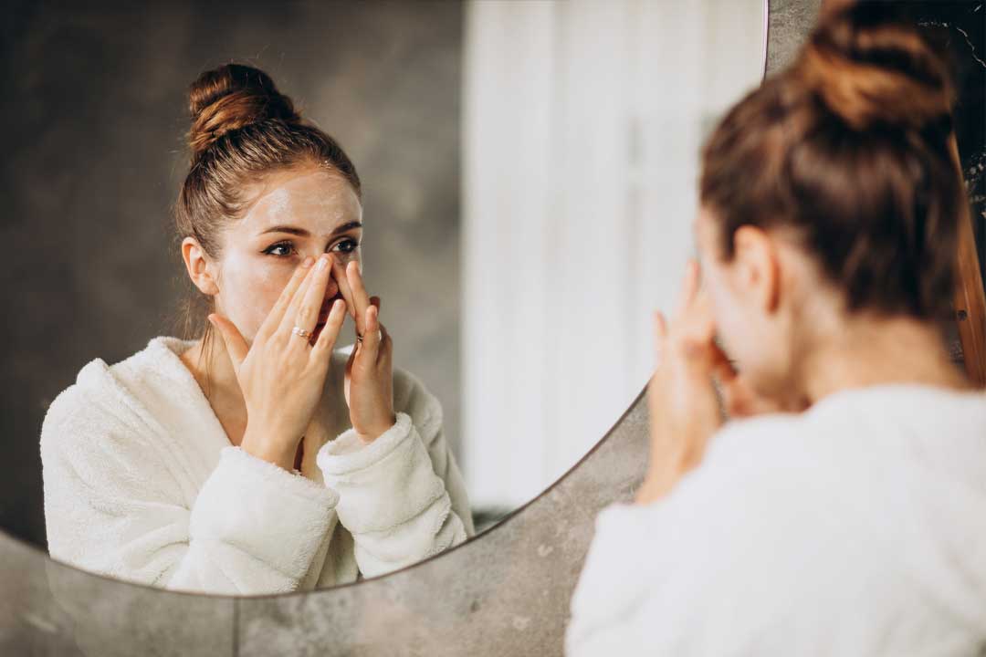 مراقبت های میکرونیدلینگ